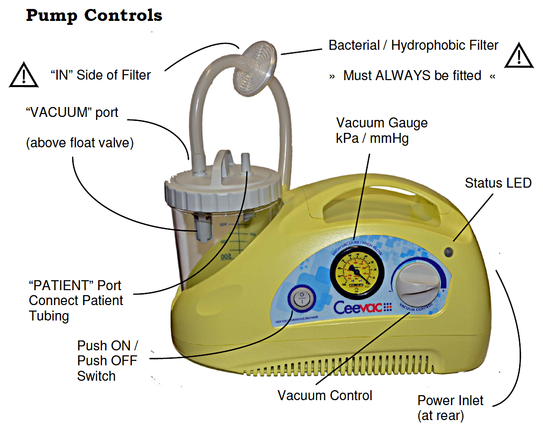 Ceevac Portable Suction Pump