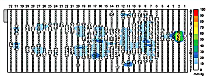 Pressure Map