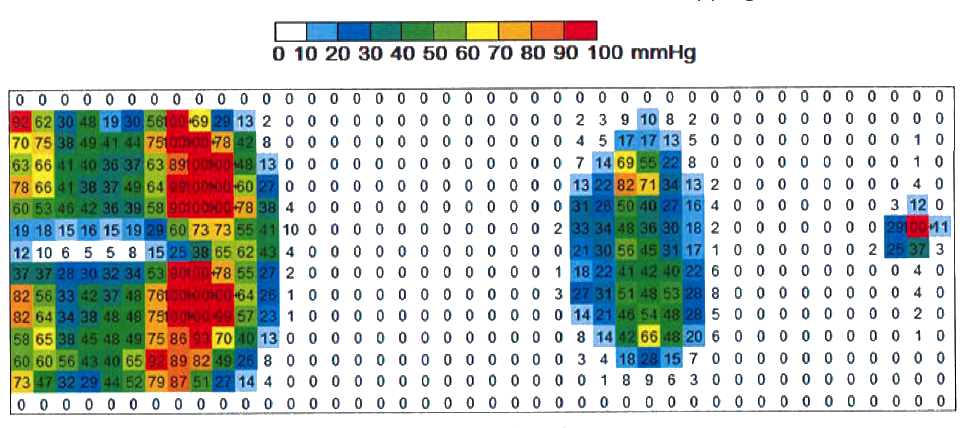 Fully reclining wheelchair pressure mapping