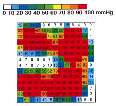 Wheelchair pressure mapping